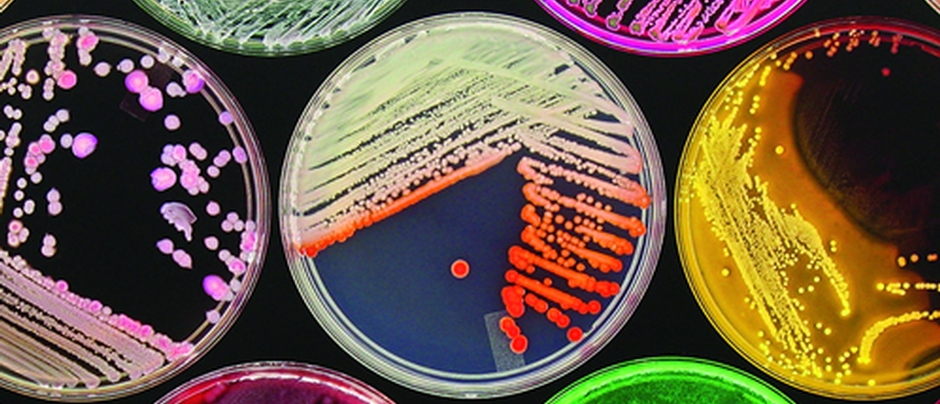 Bacterial plates