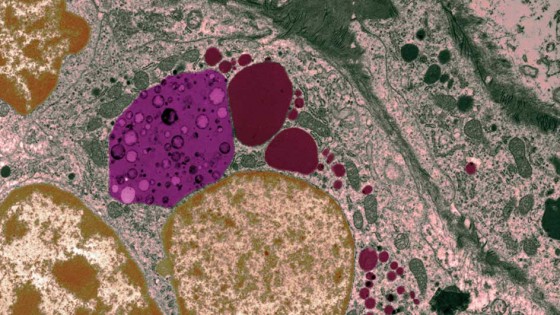 Molecular sacs of debris (pink) are delivered to the lysosome (dark red)