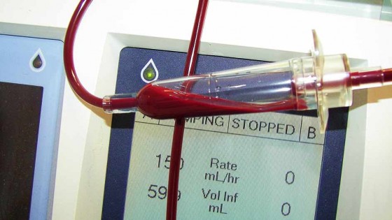 Blood transfusion