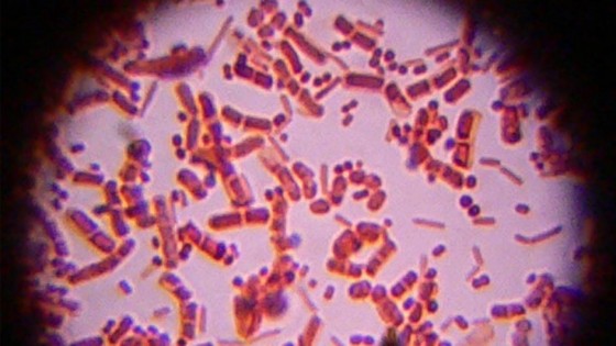superbug 560x315