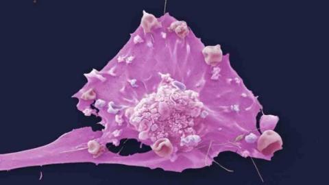breast cancer Cancer Research UK LRI EM unit 560x315