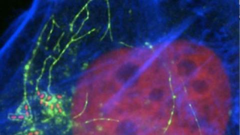 Salmonella credit Vassilis Koronakis 560x315