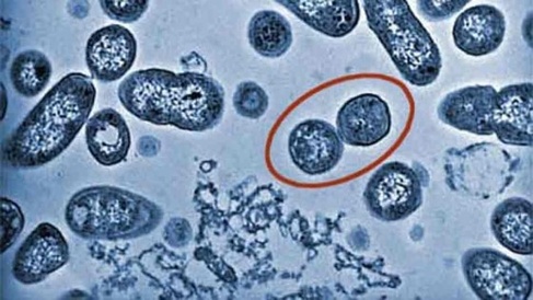090501 Salmonella 560x315