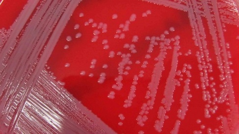 MRSA