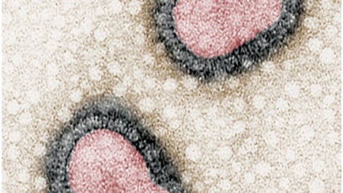 pandemic 560x315