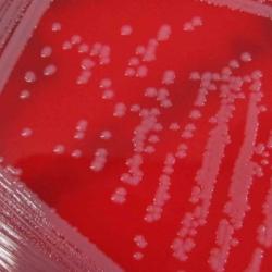 Tracking MRSA in Real Time 