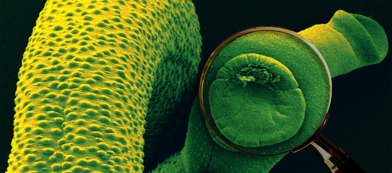 Genetic study of parasitic worms could lead to new treatments