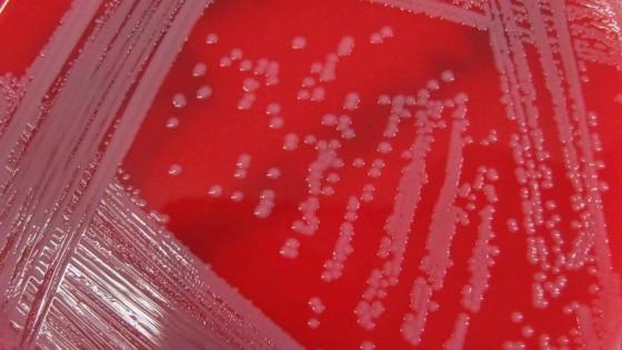 Tracking MRSA in Real Time 
